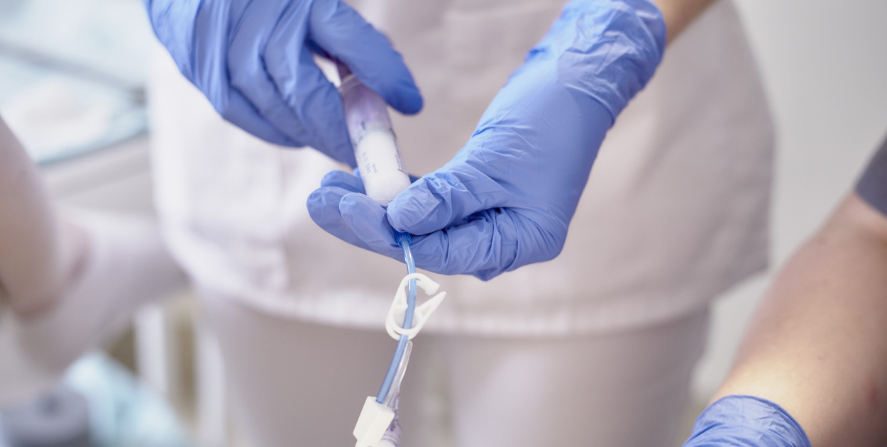 Drożność jajowodów i badanie sono-HSG